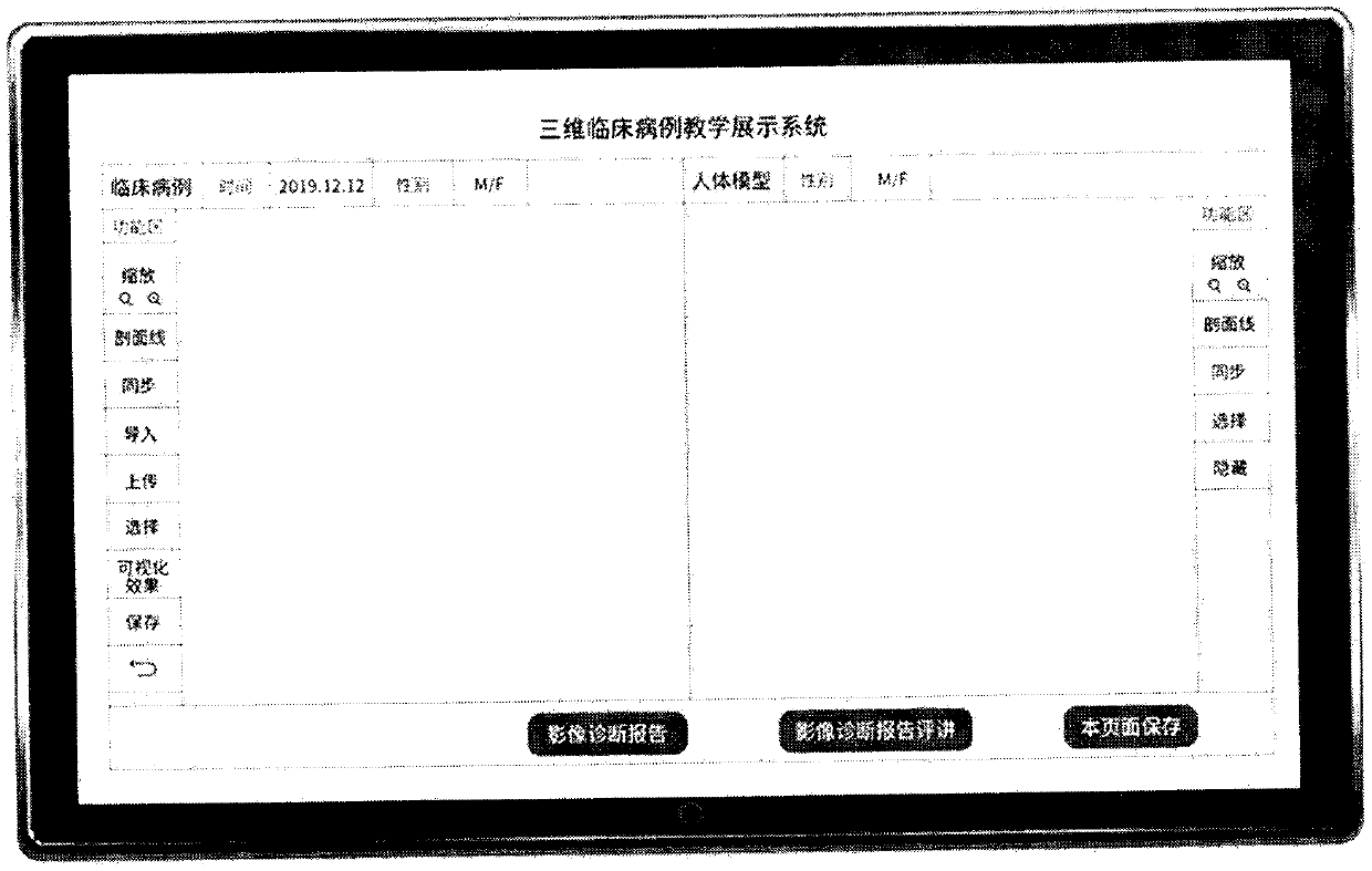 Case three-dimensional comparative teaching system for medical education