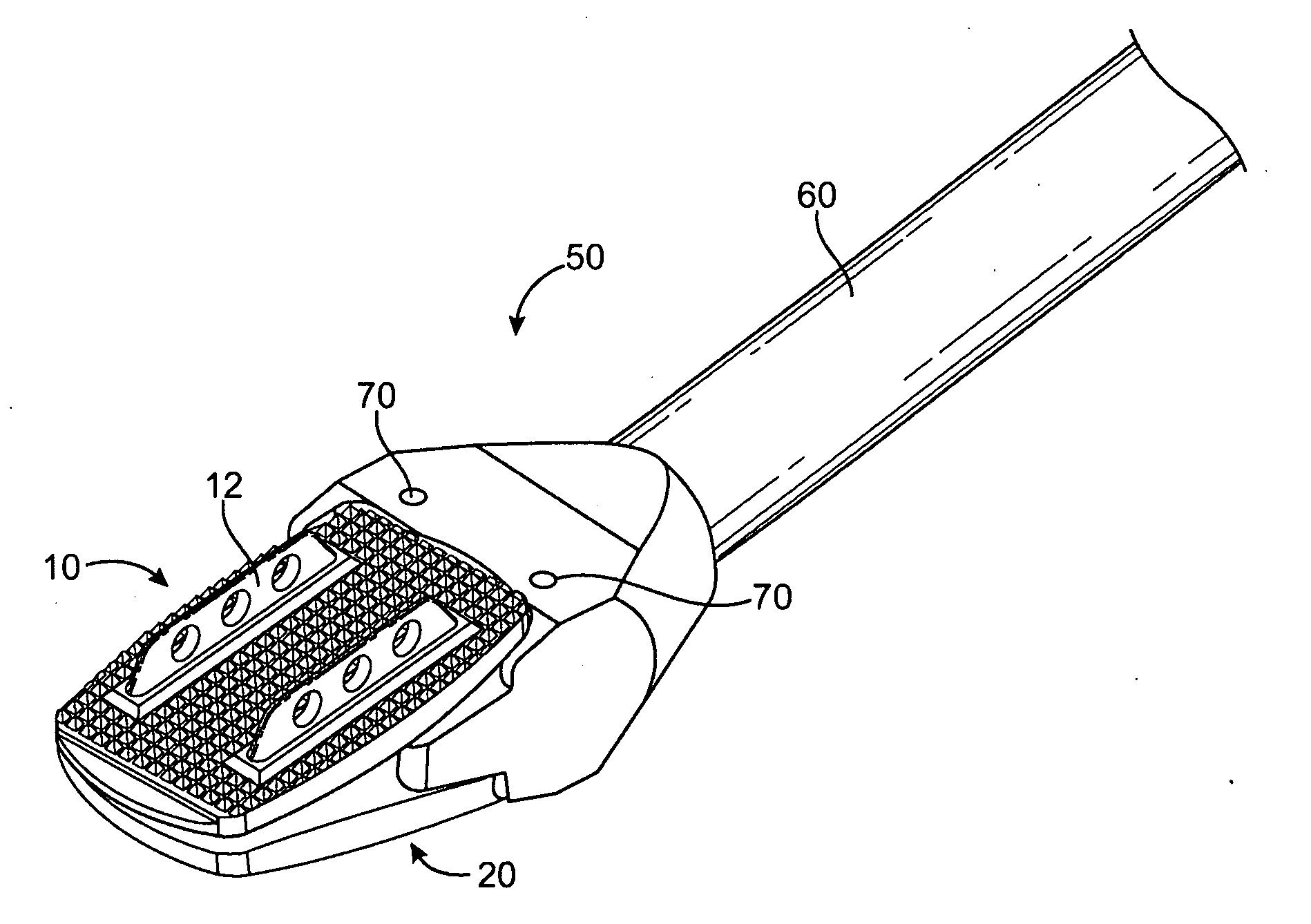 Artificial Intervertebral Disc Placement System