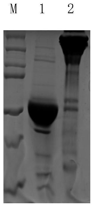 Fully humanized trivalent specific antibody for neutralizing tetanus toxin and preparation method thereof