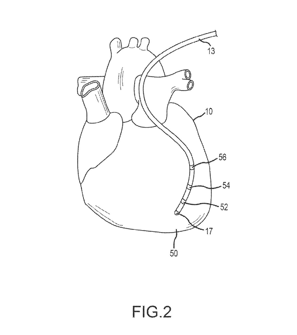 Non-contact mapping system and method