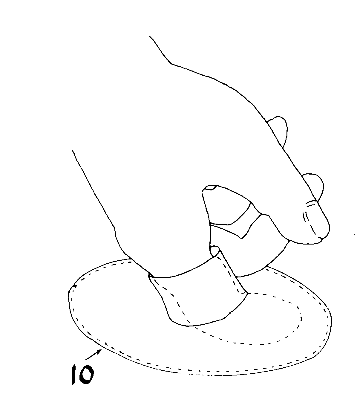 Hernial prosthesis for intraprosthetic fixation