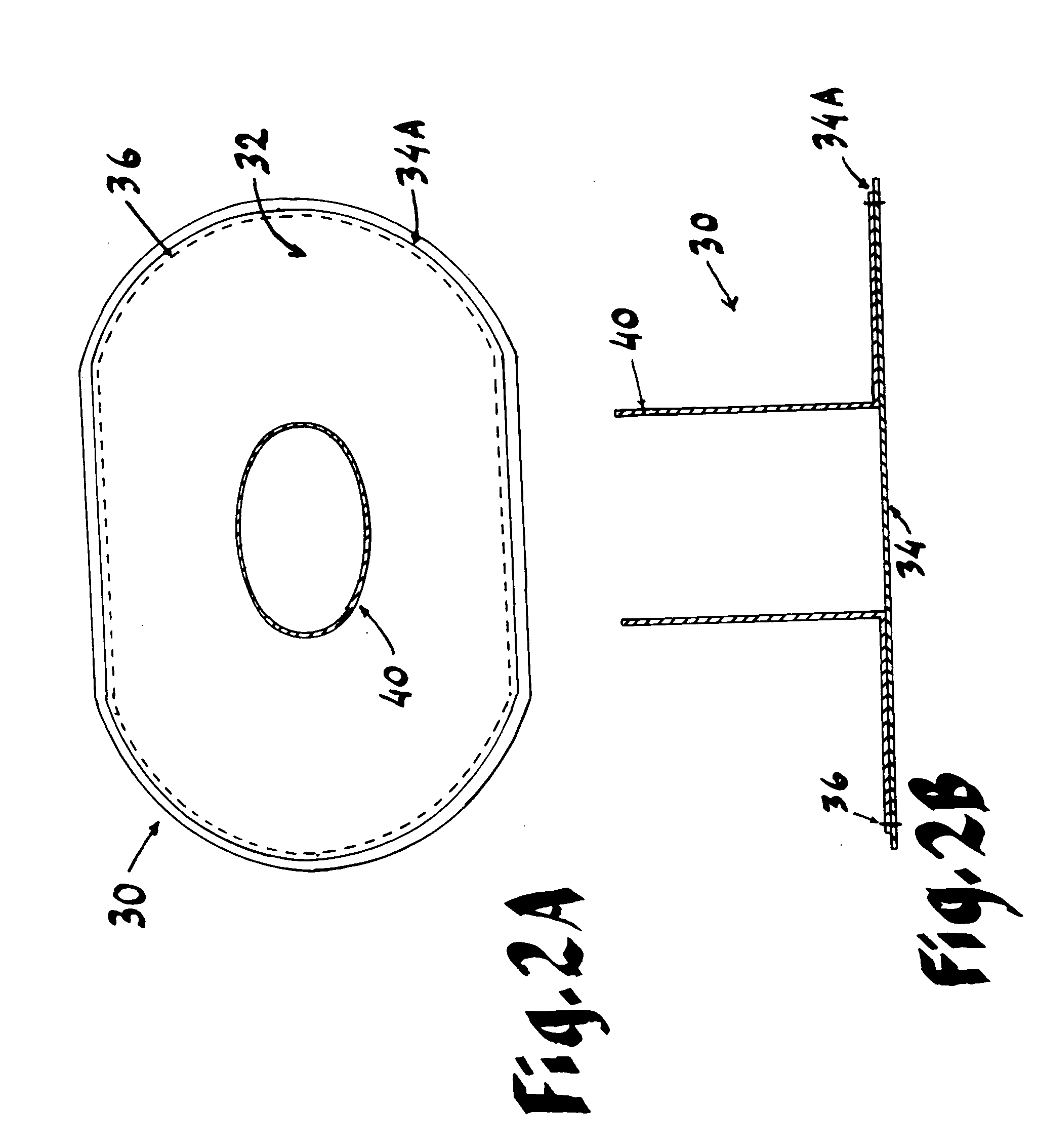 Hernial prosthesis for intraprosthetic fixation