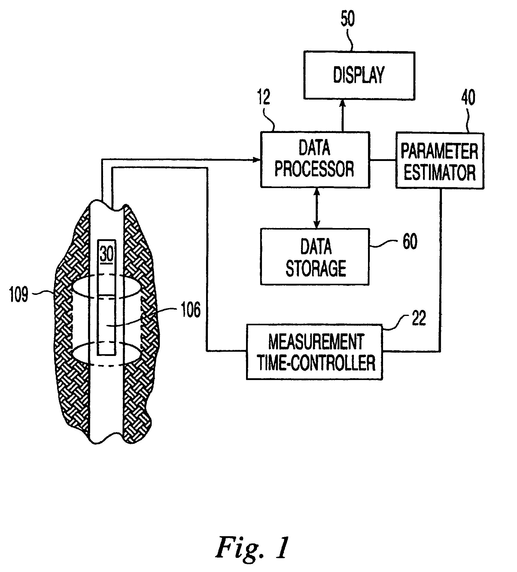 System and methods for T1-based logging