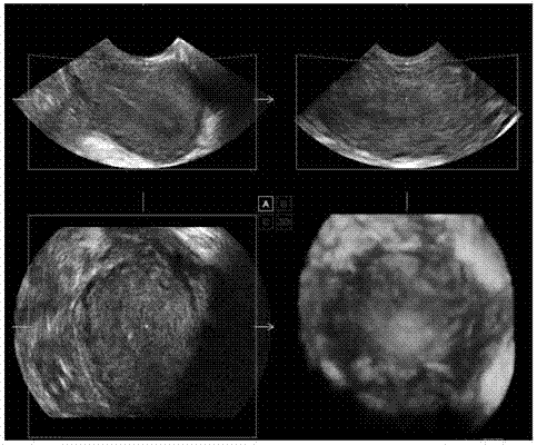 Ultrasonic imaging method and device and ultrasonic equipment thereof