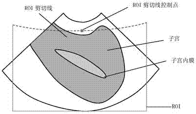 Ultrasonic imaging method and device and ultrasonic equipment thereof