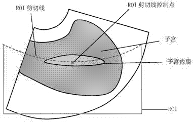 Ultrasonic imaging method and device and ultrasonic equipment thereof