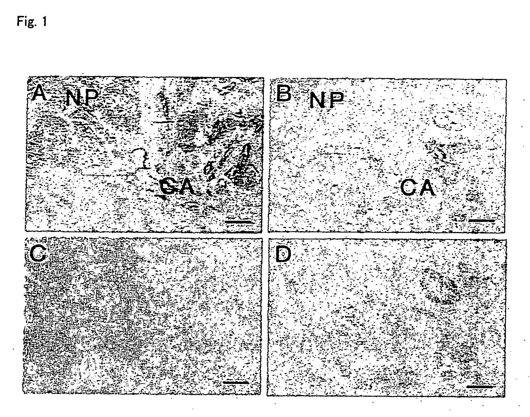 Cancer antigens and utilization thereof