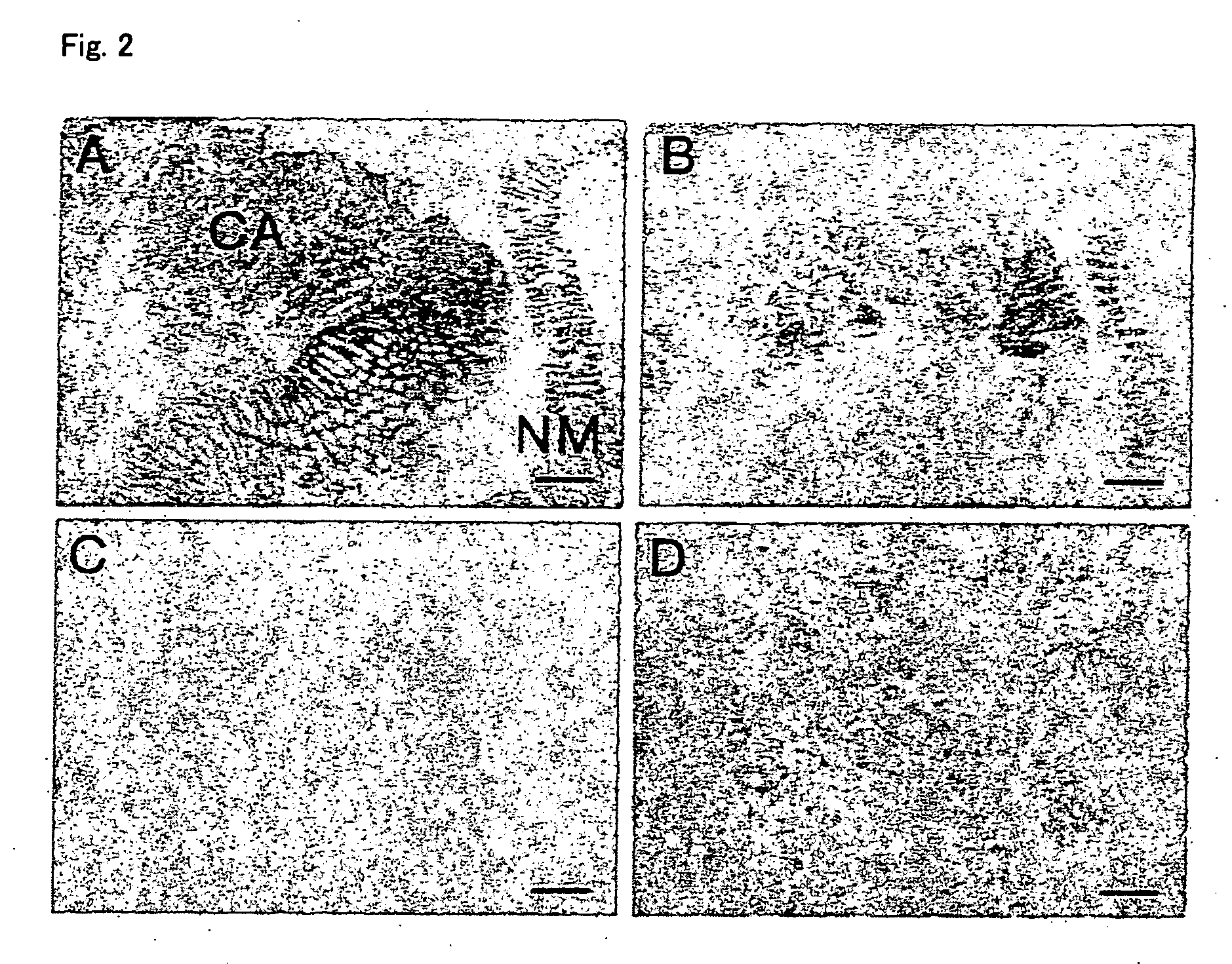 Cancer antigens and utilization thereof