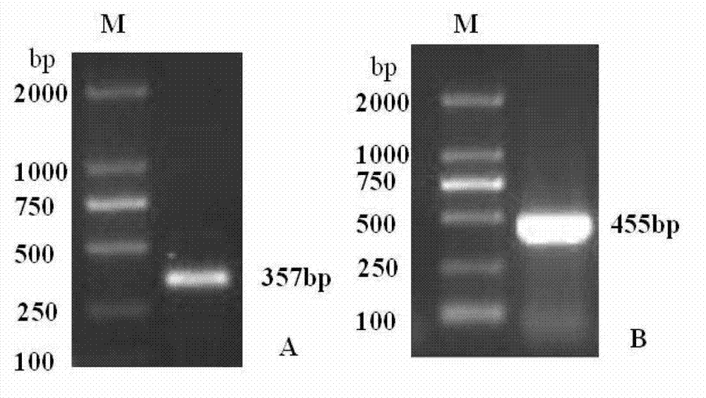 Method and special primer for simultaneously detecting cherry whether to be infected by apple chlorotic leaf spot virus and prunus necrotic ringspot virus