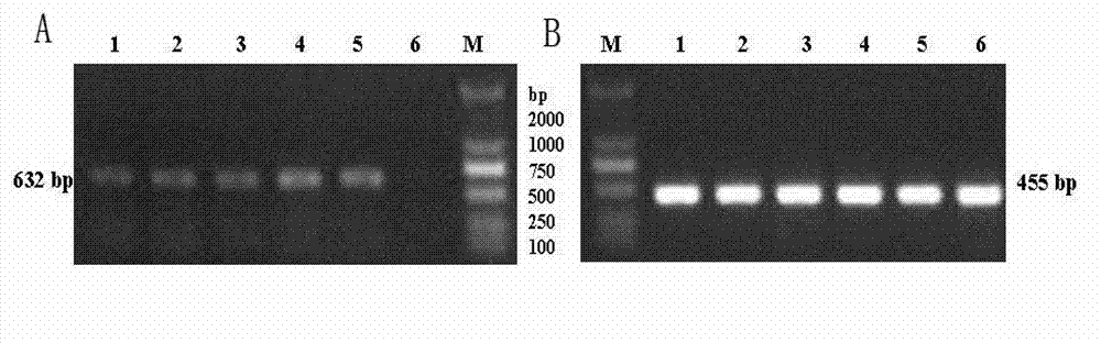 Method and special primer for simultaneously detecting cherry whether to be infected by apple chlorotic leaf spot virus and prunus necrotic ringspot virus