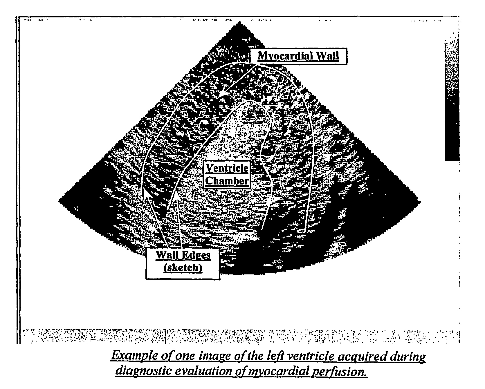 M-tracking for space-time image