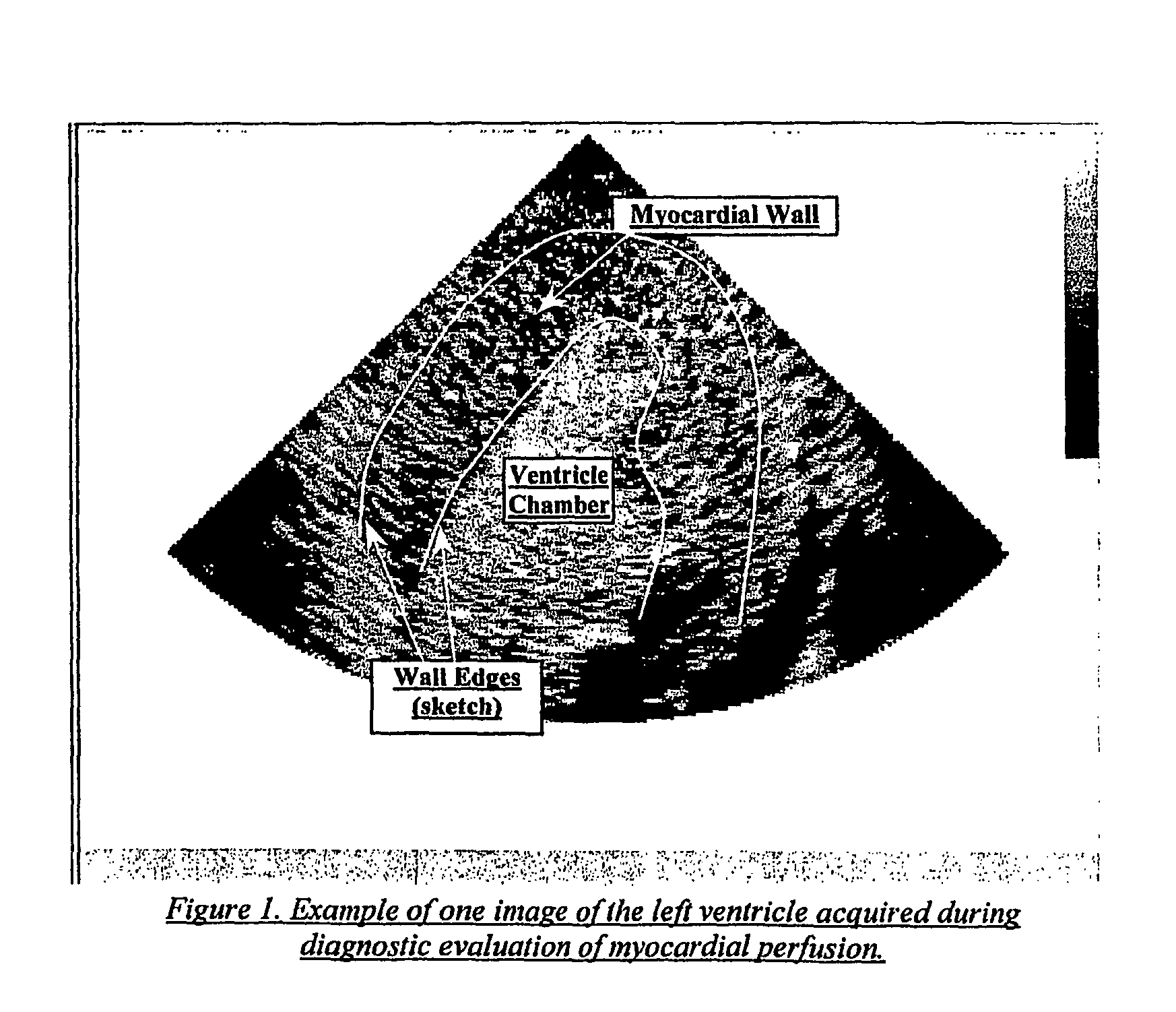 M-tracking for space-time image