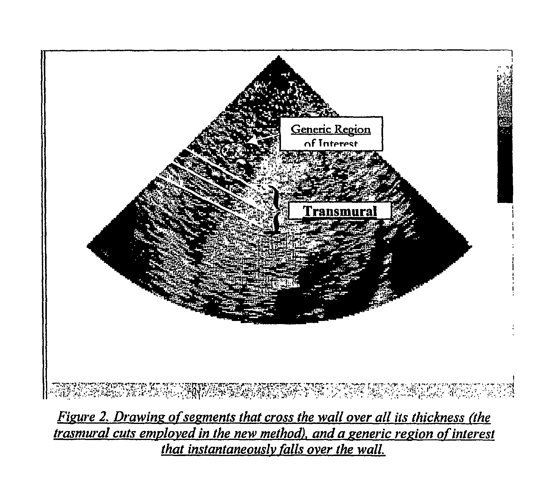 M-tracking for space-time image