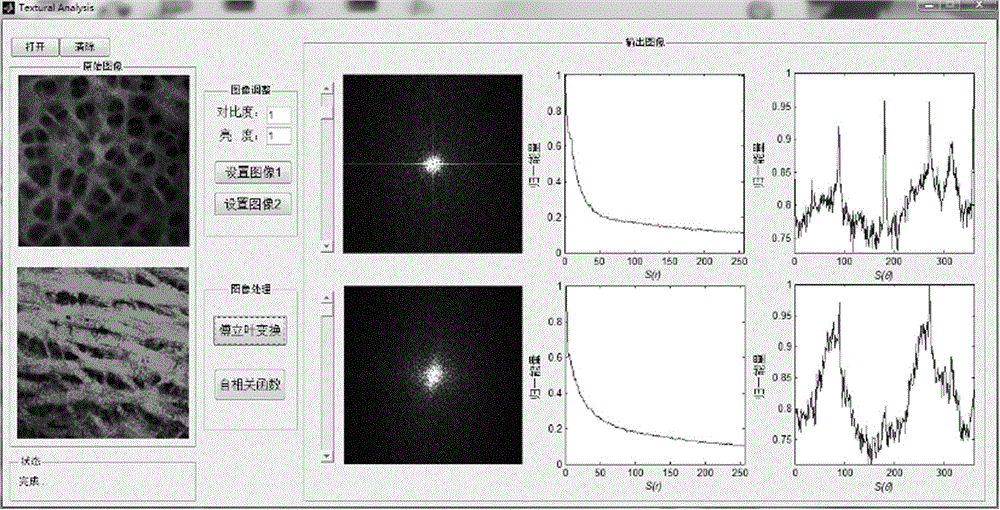 Medical image texture analysis system