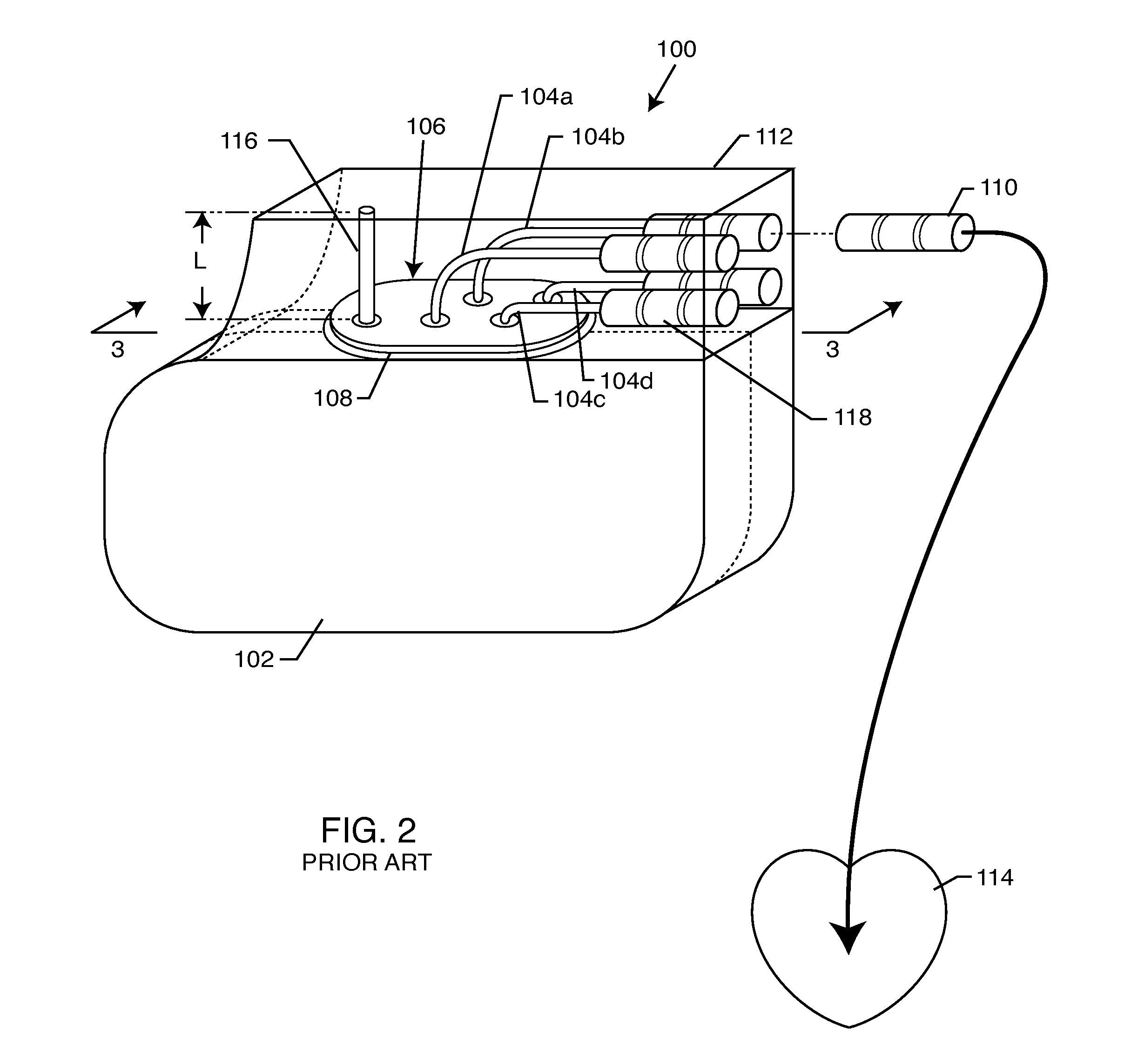 Implantable lead bandstop filter employing an inductive coil with parasitic capacitance to enhance MRI compatibility of active medical devices