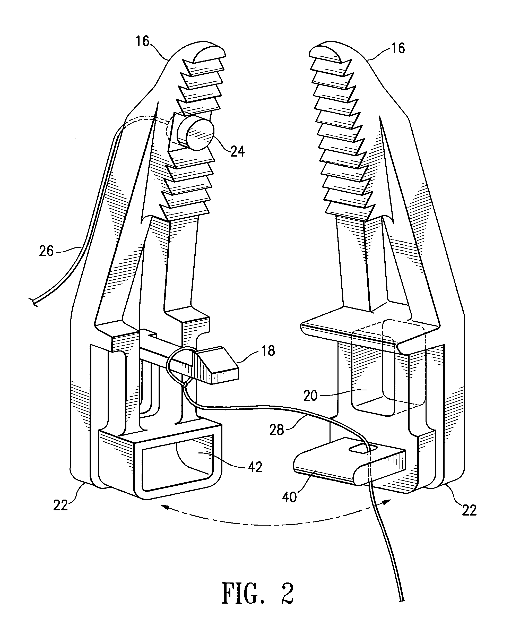 Method and apparatus for the detection and ligation of uterine arteries