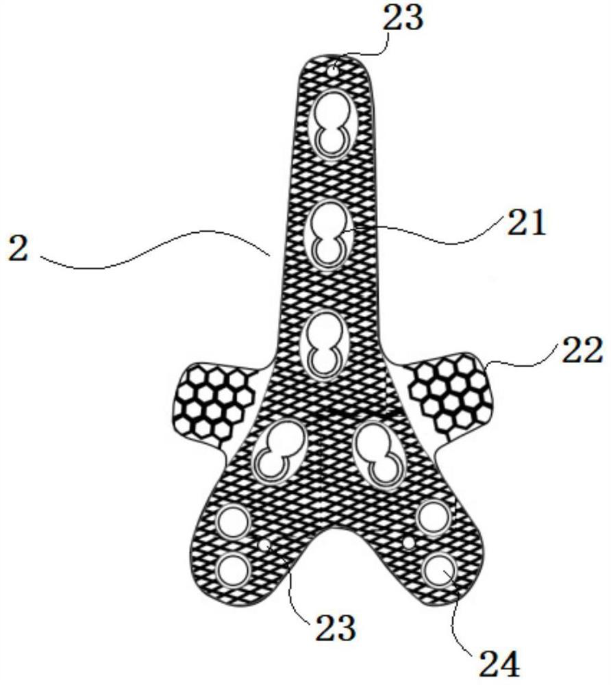 Locking plate for distal tibia