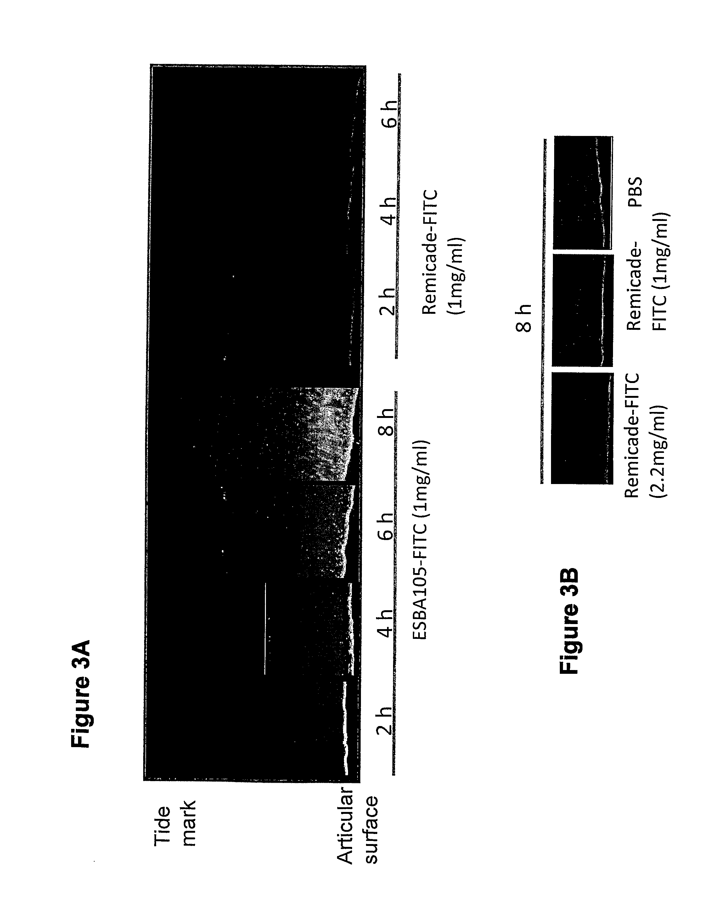 Antigen-binding polypeptides against cartilage degeneration