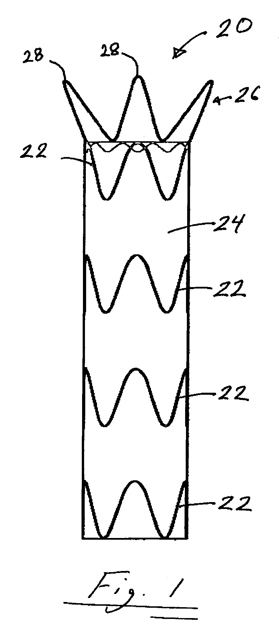 Stent Graft Delivery System and Method of Use