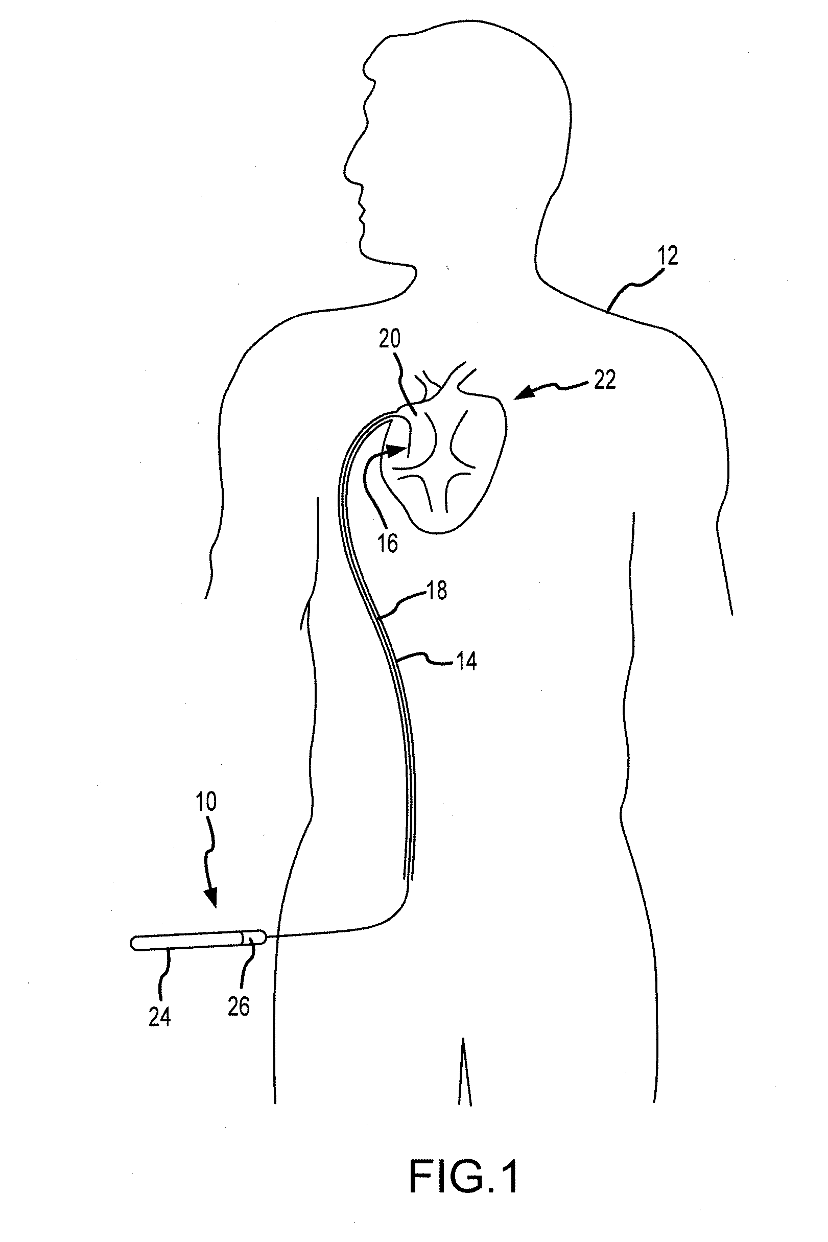 Elongate medical device handle autolock