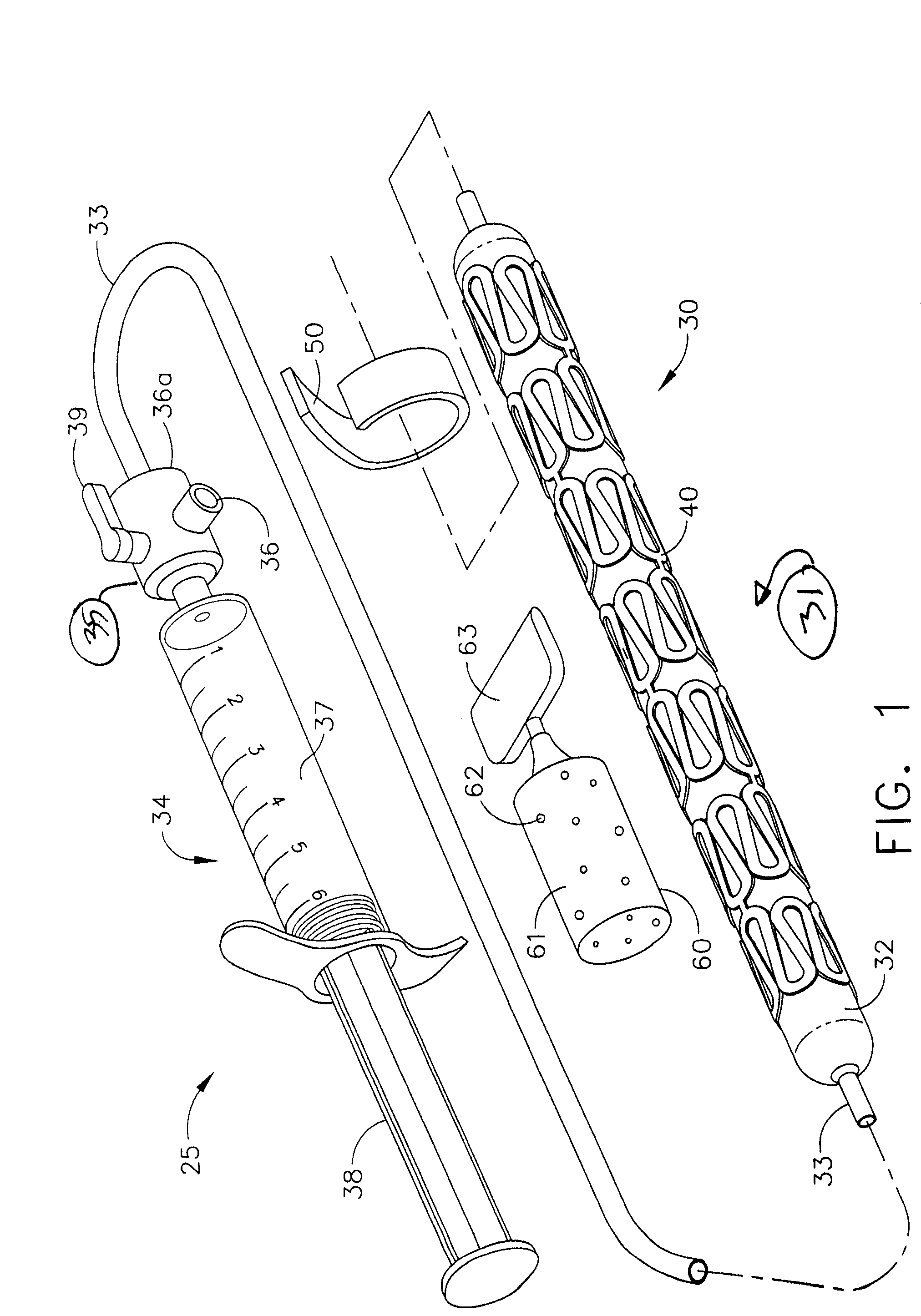 Method of Performing An End-to-End Anastomosis Using a Stent and an Adhesive