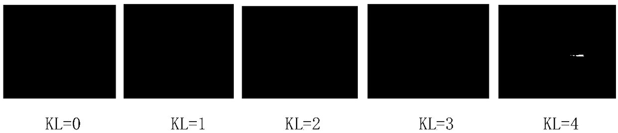 Bone joint X-ray film automatic identification and grading method