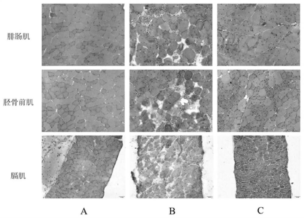 Application of Ozanimod in preparation of medicine for treating muscular dystrophy