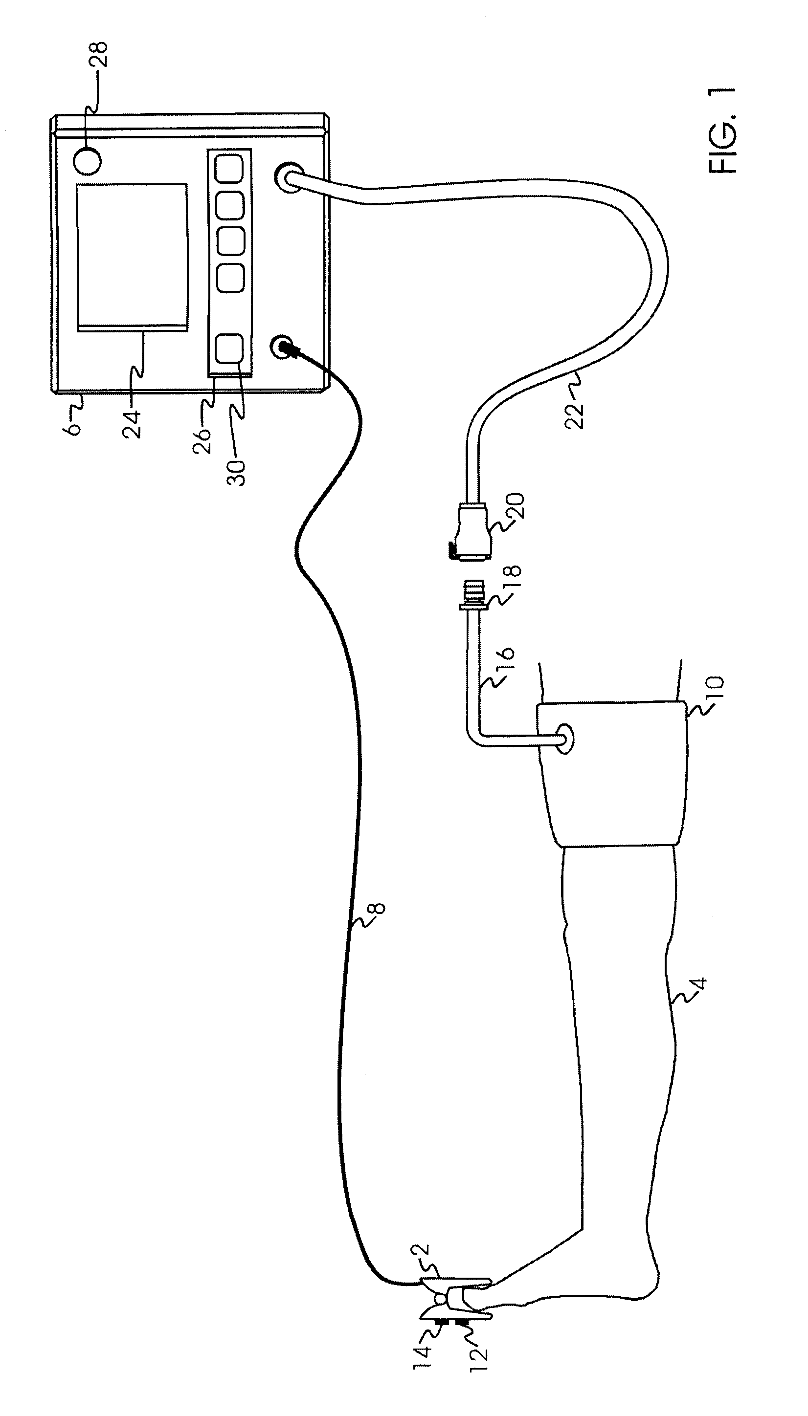 Tourniquet Apparatus for Measuring Limb Occlusion Pressure