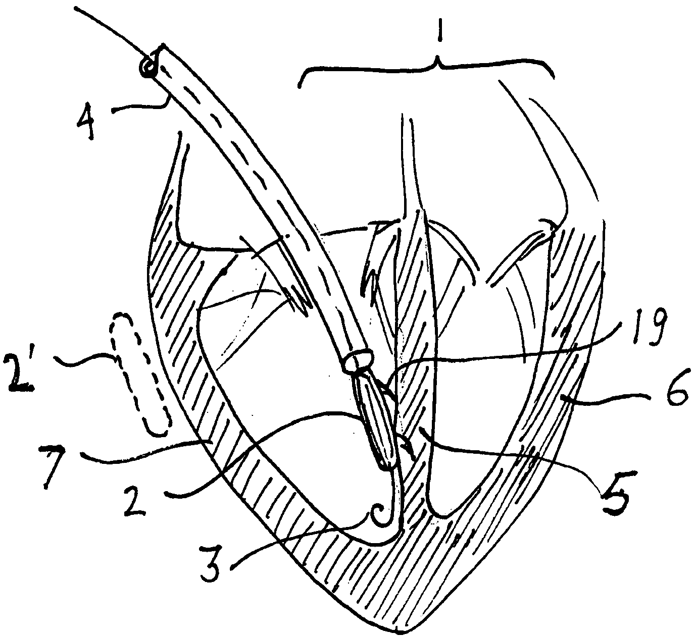 Miniature defibrillator