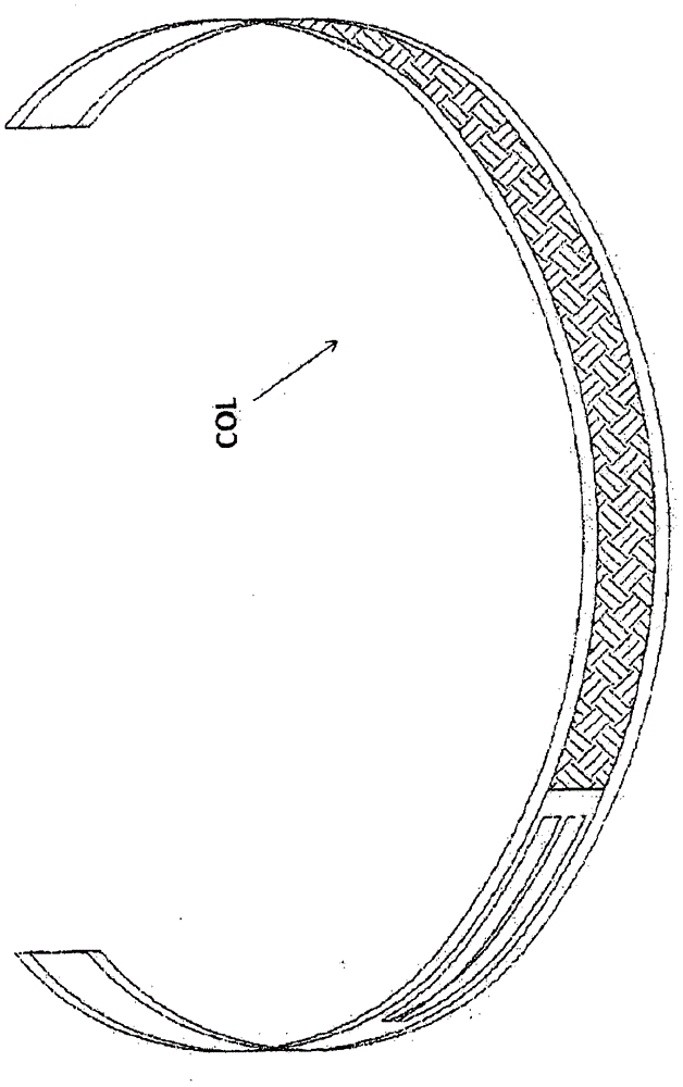 Medical device for the detection, measurement, in an unbloody and non-invasive manner, and transmission of vital, biomedical parameters, such as cardiovascular and respiratory parameters, of a human body