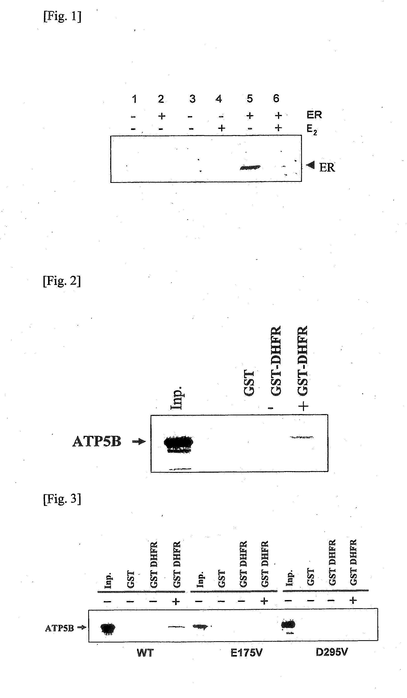 Method for identifying target protein of drug and method for screening therapeutic agent for diabetes using the target protein