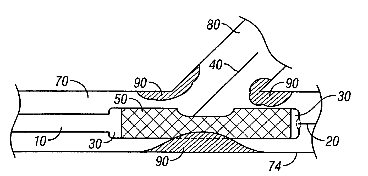 Bifurcation stent and delivery system