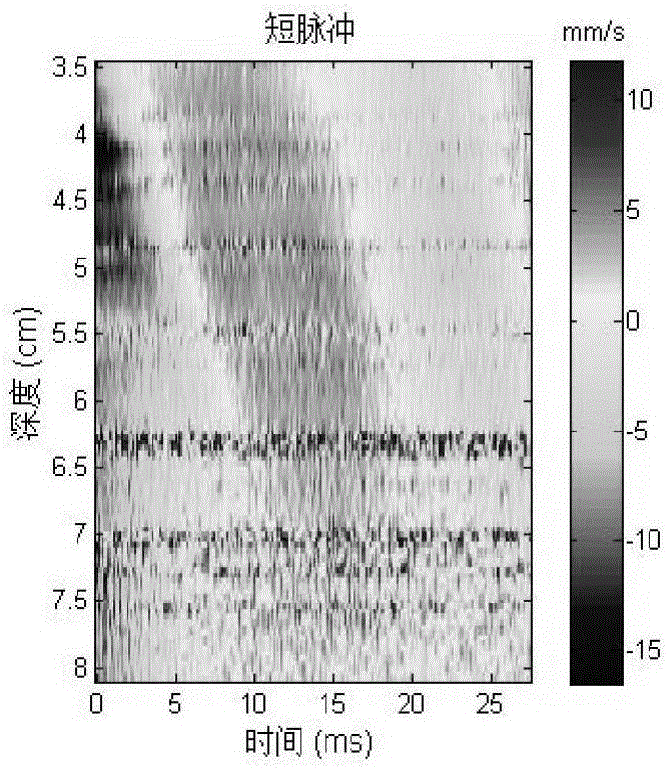 Instantaneous elasticity imaging code detection method and system