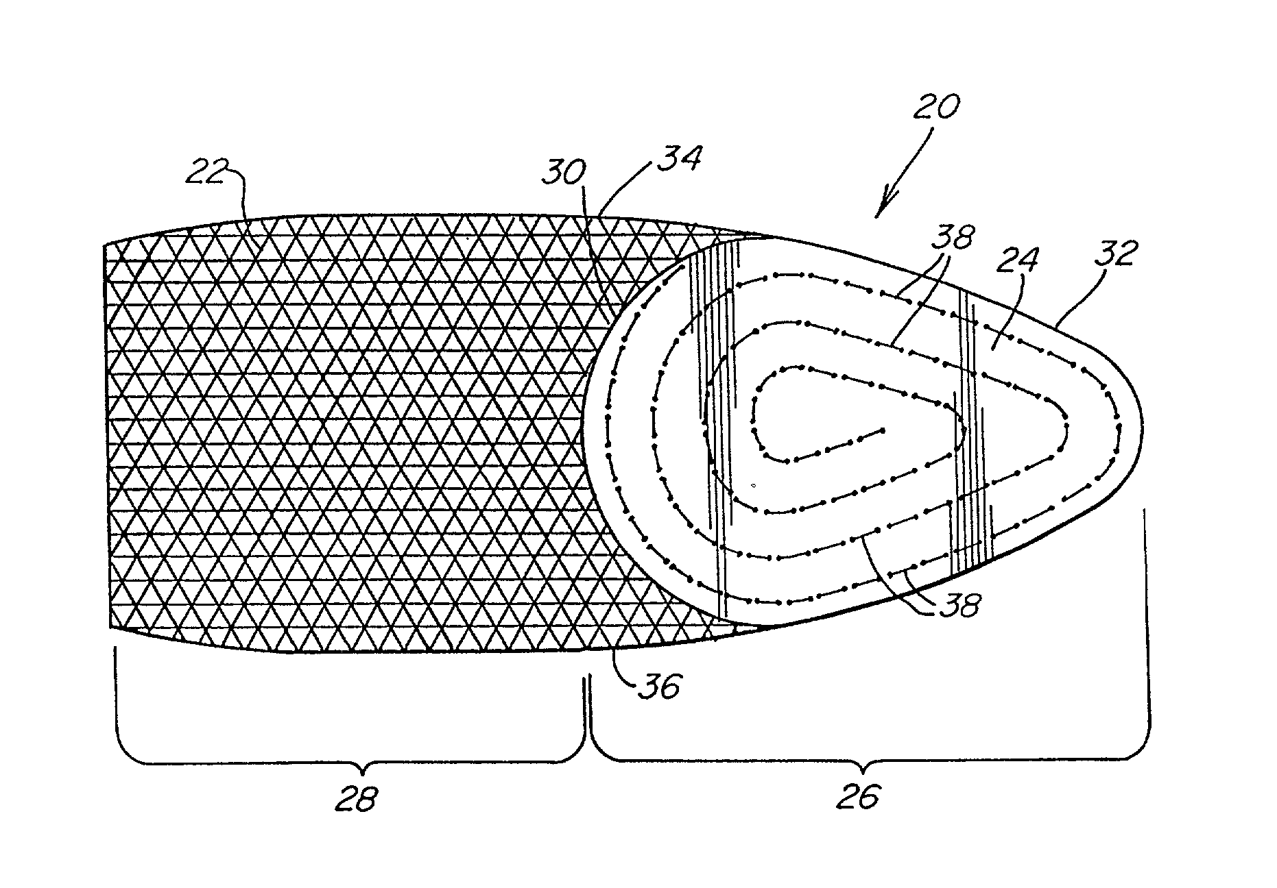 Prosthetic repair fabric