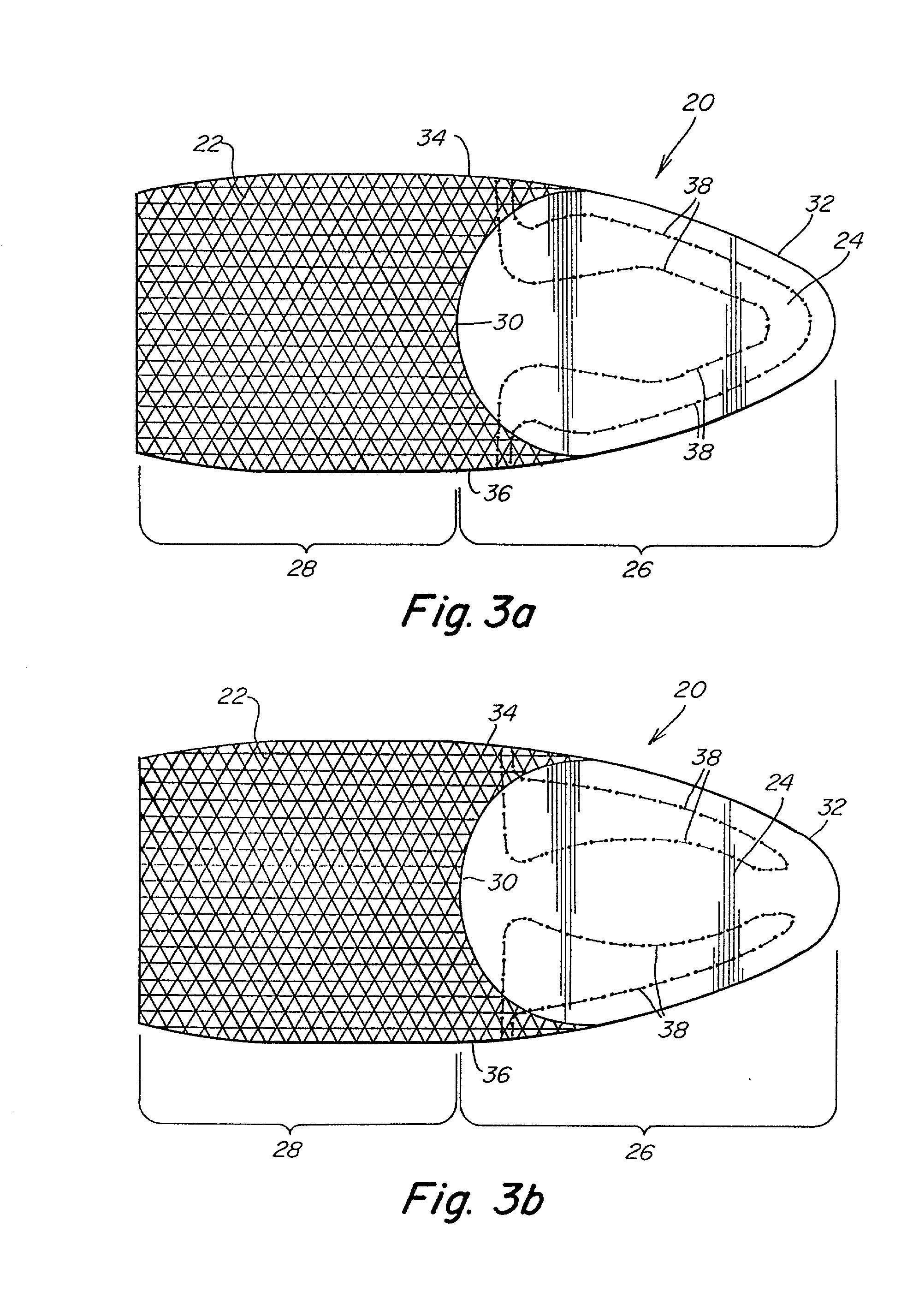 Prosthetic repair fabric