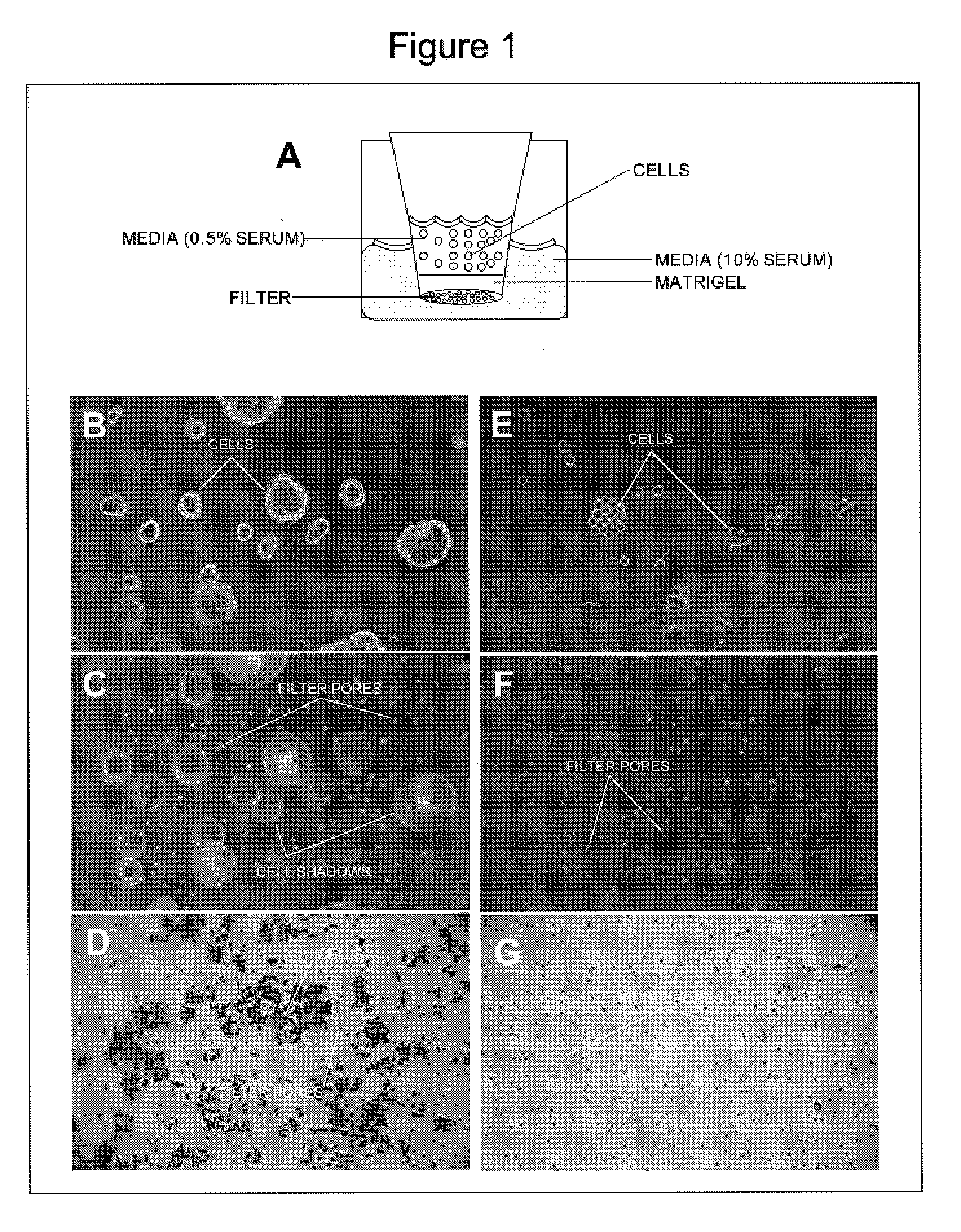 Methods for inhibiting cancer and scar formation