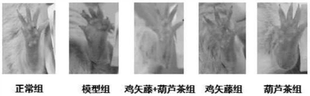 Composition of vine vine and gourd tea with anti-inflammatory effect and its preparation method and application