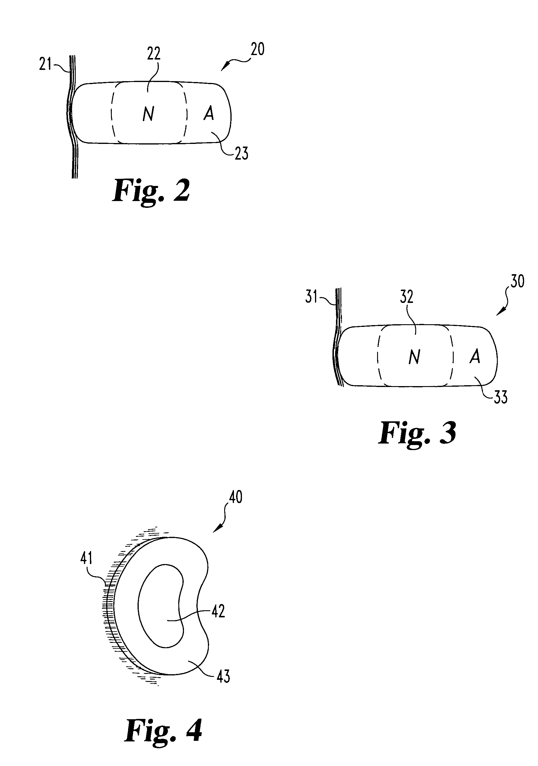 Allogenic/xenogenic implants and methods for augmenting or repairing intervertebral discs