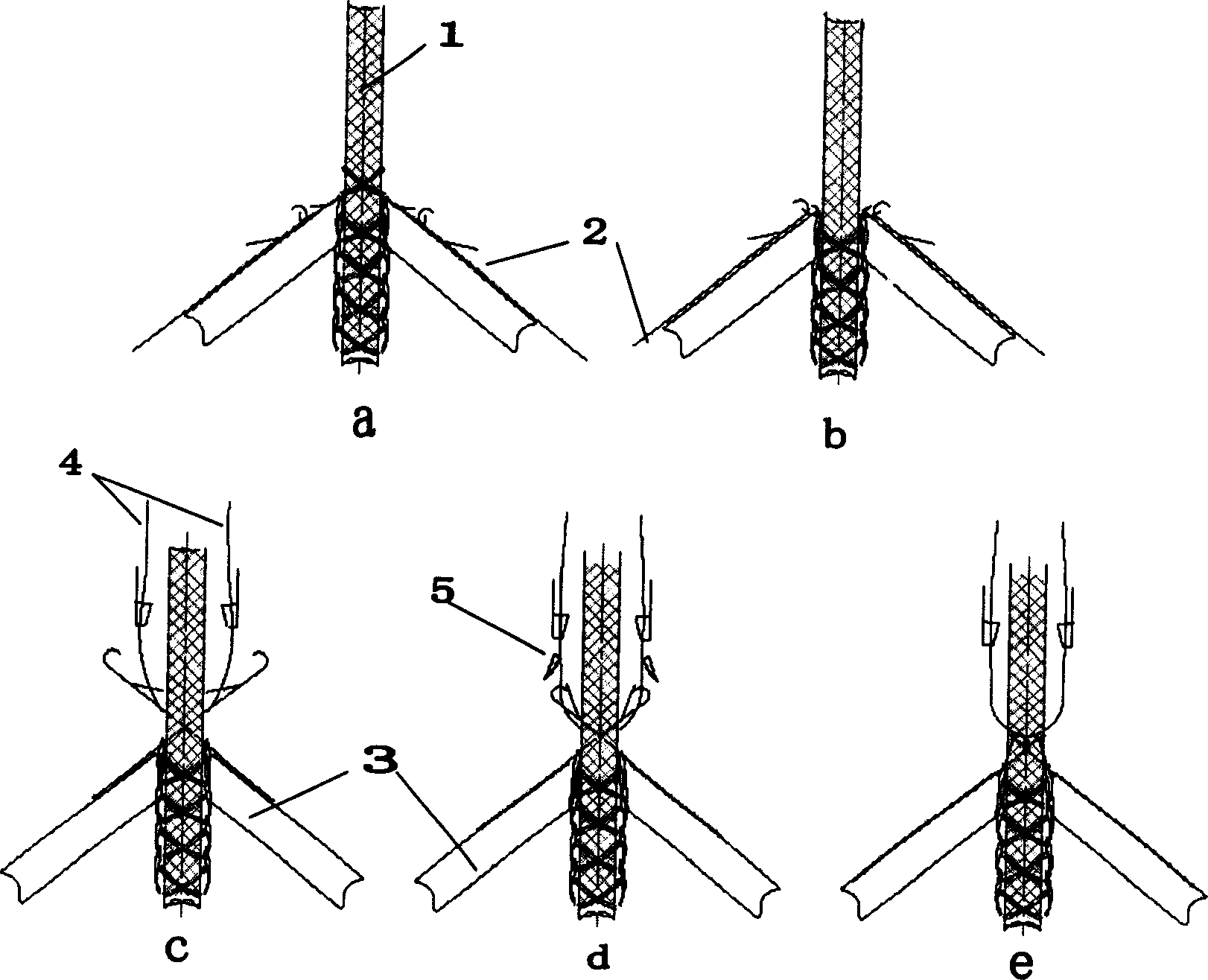 Method for weaving braided fabric with bound edge of double sides from weft knitting machine