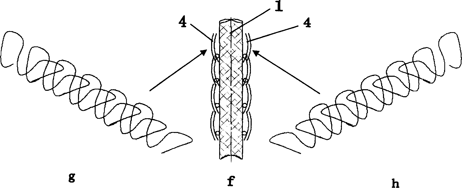 Method for weaving braided fabric with bound edge of double sides from weft knitting machine