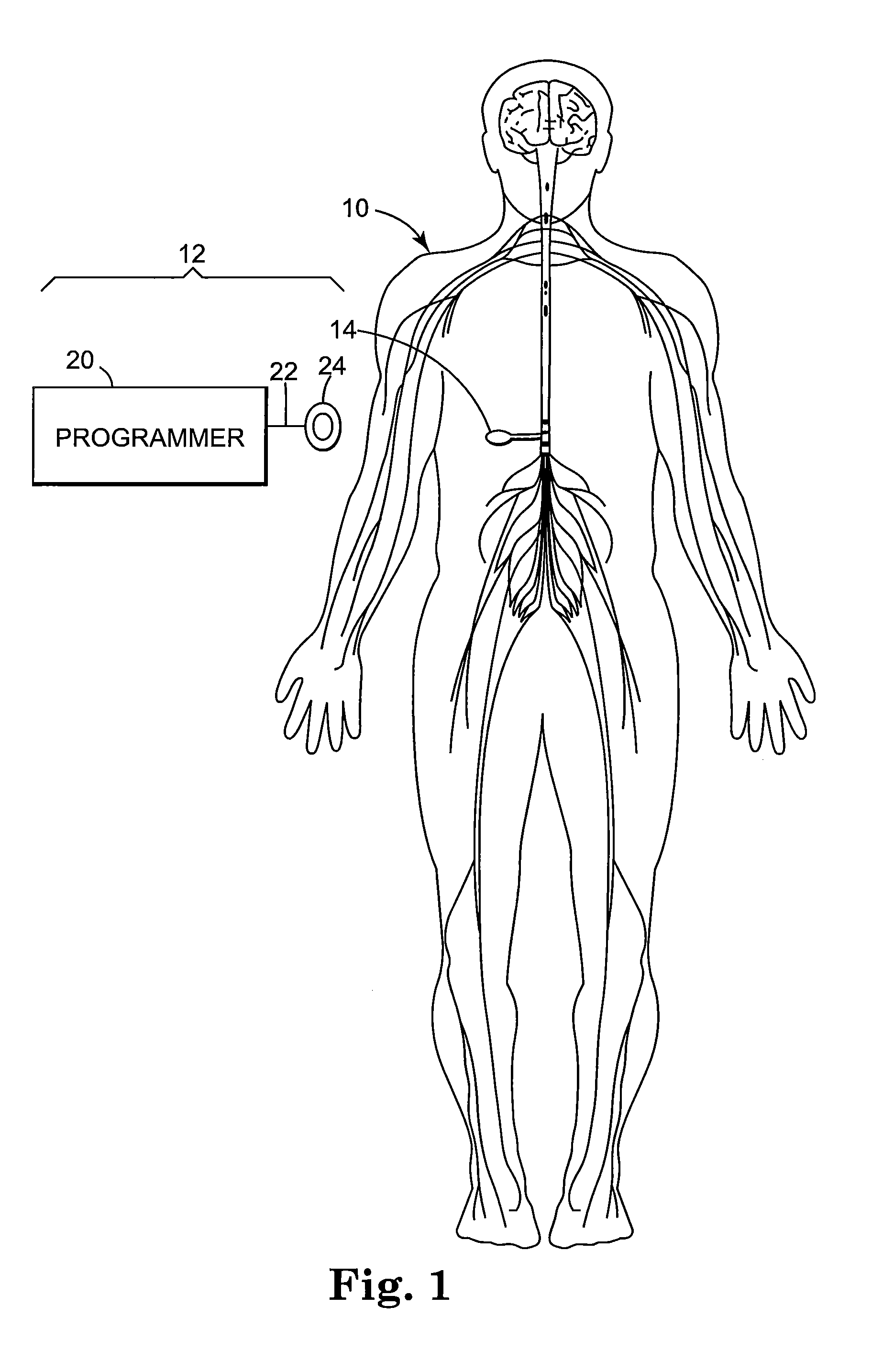 Infusion system programmable in flex mode