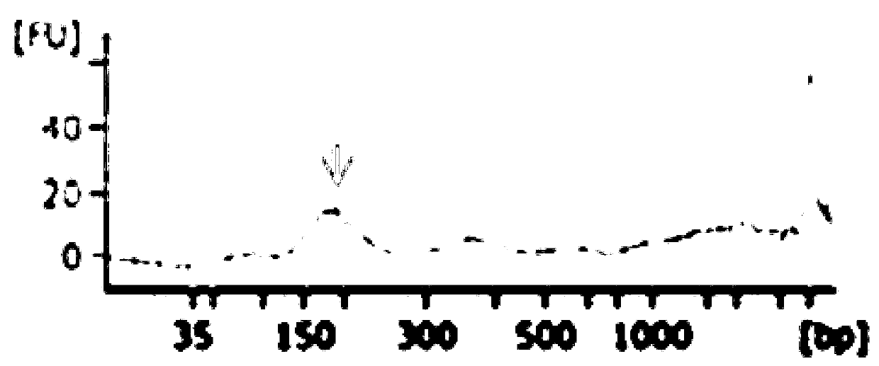 Composition and method for preserving nucleic acid in urine