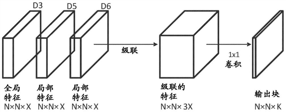 Neural network based identification of areas of interest in digital pathology images