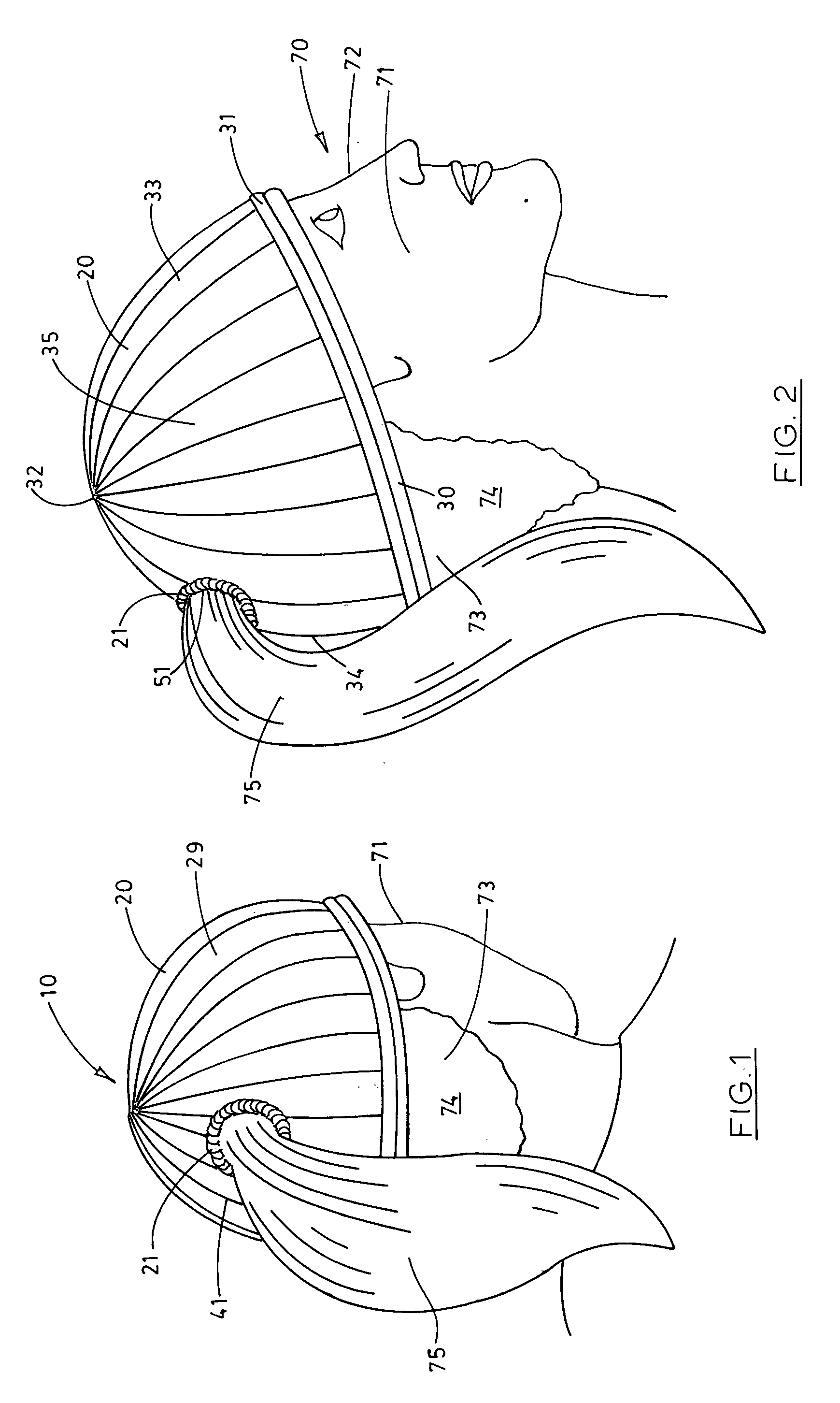 Securing device