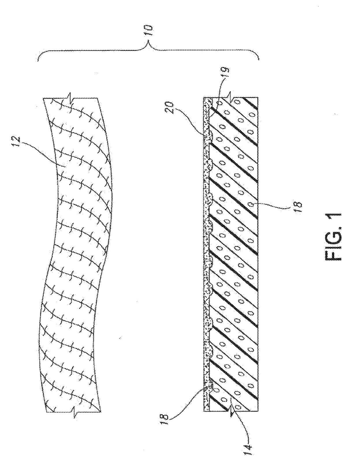 Composite ePTFE/Textile Prosthesis