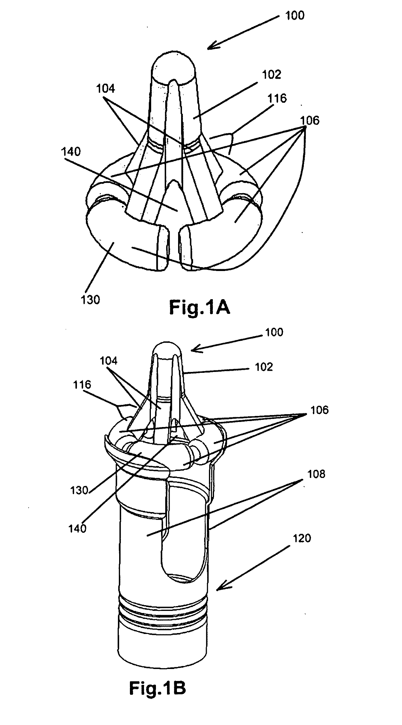 Female urinary incontinence devices