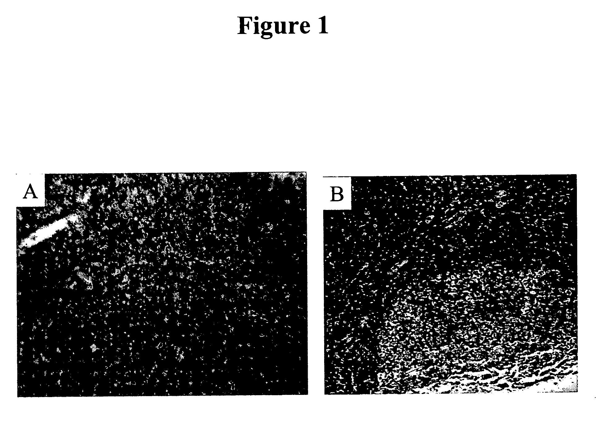 Cytotoxicity mediation of cells evidencing surface expression of CD44