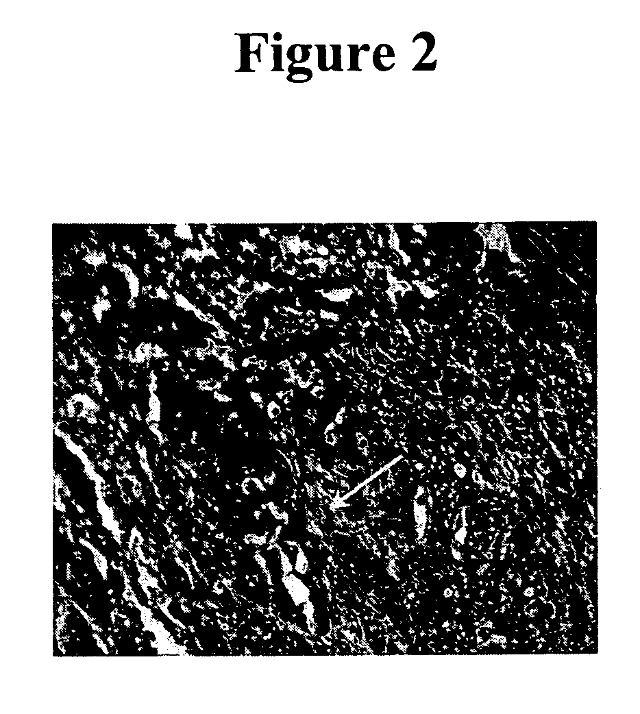 Cytotoxicity mediation of cells evidencing surface expression of CD44