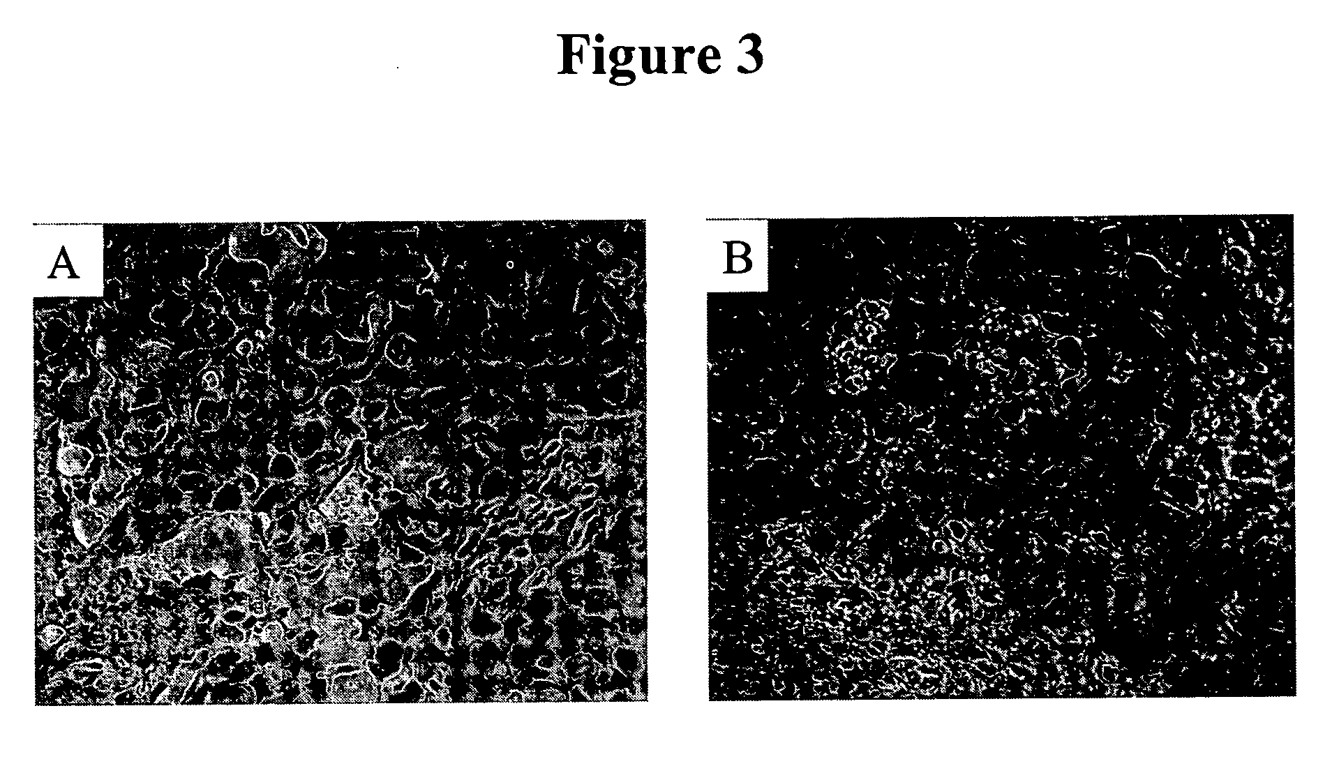 Cytotoxicity mediation of cells evidencing surface expression of CD44