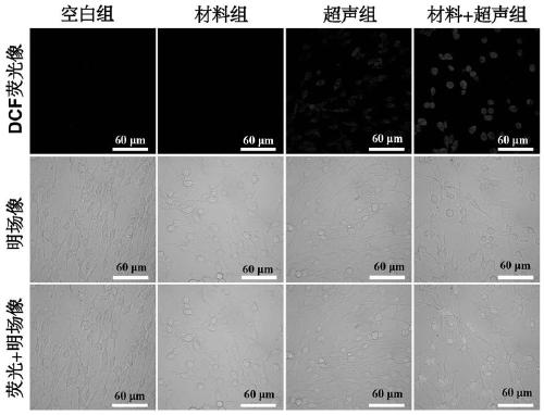 Nano diagnosis and treatment agent material capable of efficiently crossing blood-brain barrier and targeting in-situ glioma and preparation method of nano diagnosis and treatment agent material